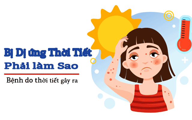 Những thông tin dị ứng thời tiết - Bị dị ứng thời tiết phải làm sao?