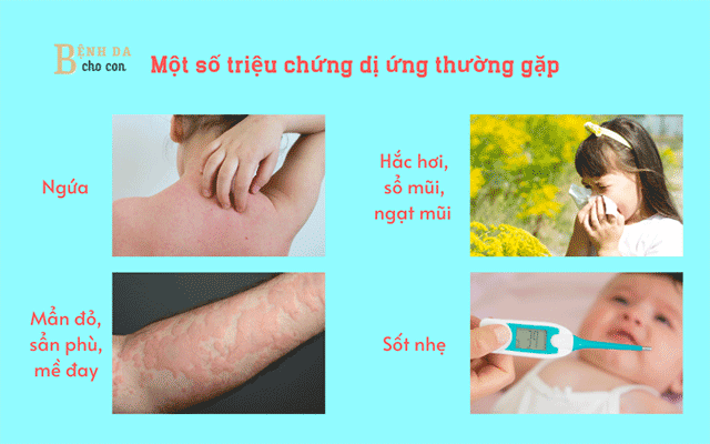 Triệu chứng dị ứng thời tiết và cách điều trị, phòng ngừa cho bé.