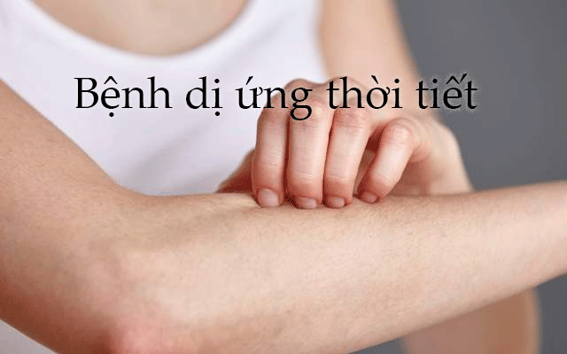 Bệnh dị ứng thời tiết và hướng dẫn điều trị hiệu quả nhất