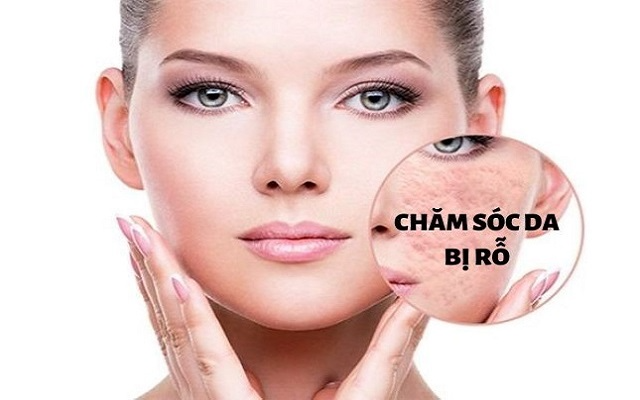 Cách chăm sóc da mặt bị rỗ chi tiết từng bước, da mịn trở lại