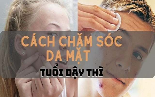 Cẩm nang chăm sóc da mặt tuổi dậy thì: sáng khỏe, không mụn