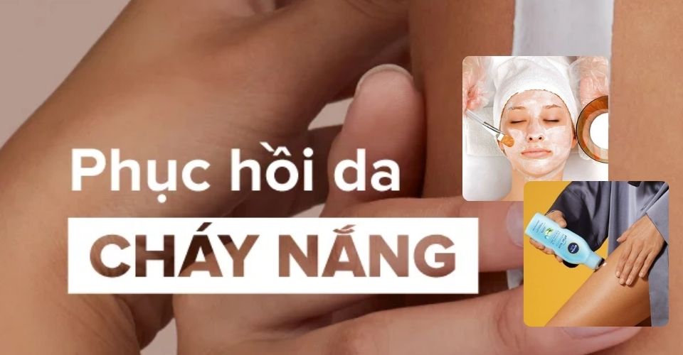 Cách phục hồi da bị cháy nắng nhanh 3s, không để lại dấu vết