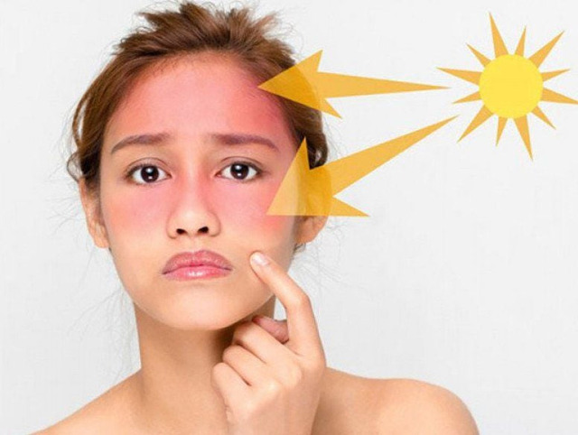  Tia UVA gây ra hiện tượng lão hóa sớm