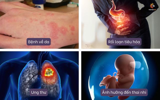 Hậu quả của ô nhiễm môi trường nước đến sức khỏe con người