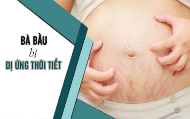 Nguyên nhân bà bầu bị dị ứng thời tiết