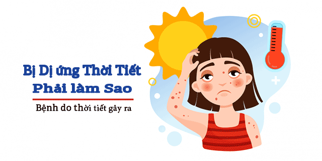 Da mặt bị dị ứng thời tiết phải làm sao?