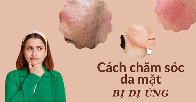 Chăm sóc da mặt bị dị ứng đúng cách 