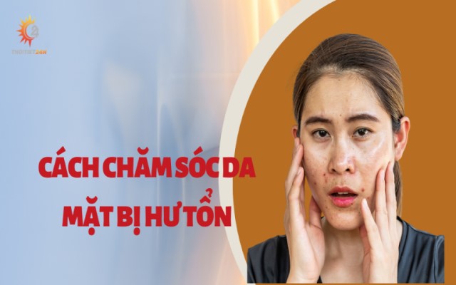 Hướng dẫn cách chăm sóc da mặt bị hư tổn 