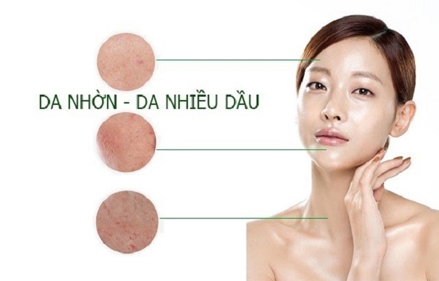 Nguyên nhân dẫn đến da dầu 