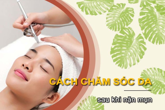 Bí quyết chăm sóc da mặt sau nặn mụn 