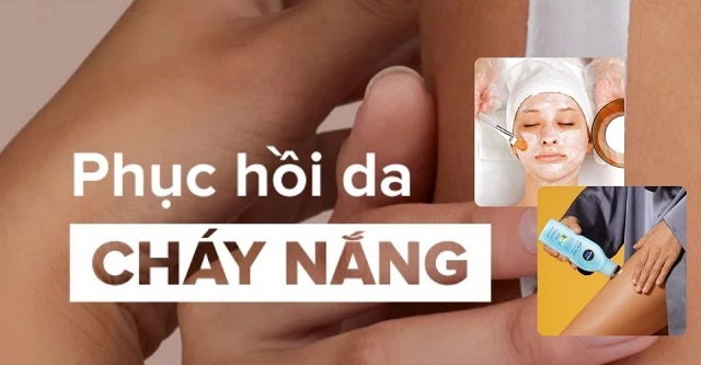 Cách phục hồi da bị cháy nắng nhanh