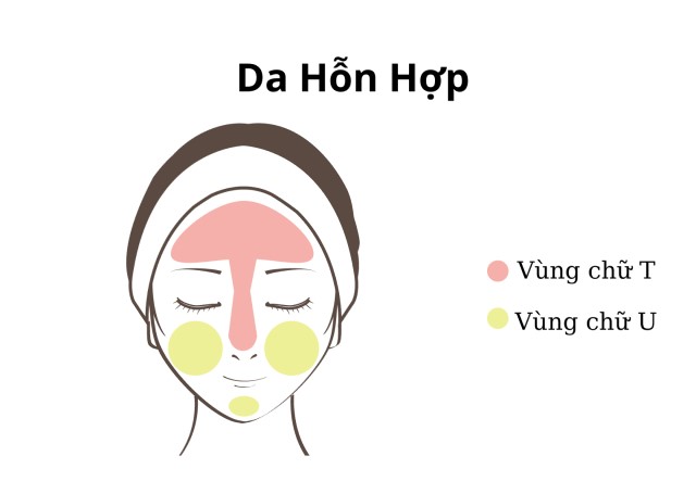 Da hỗn hợp có những đặc điểm cơ bản nào?