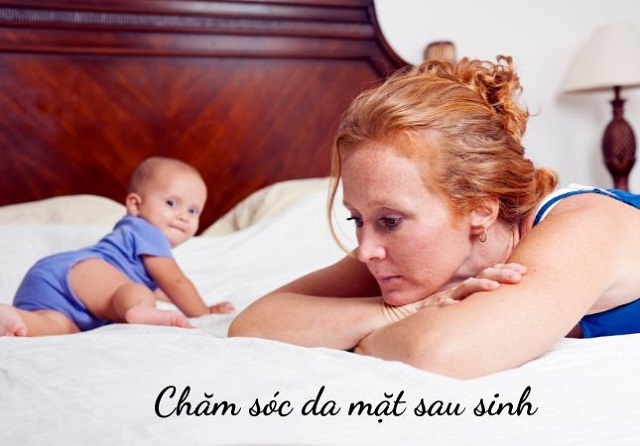 Chăm sóc da cho mẹ sau sinh 