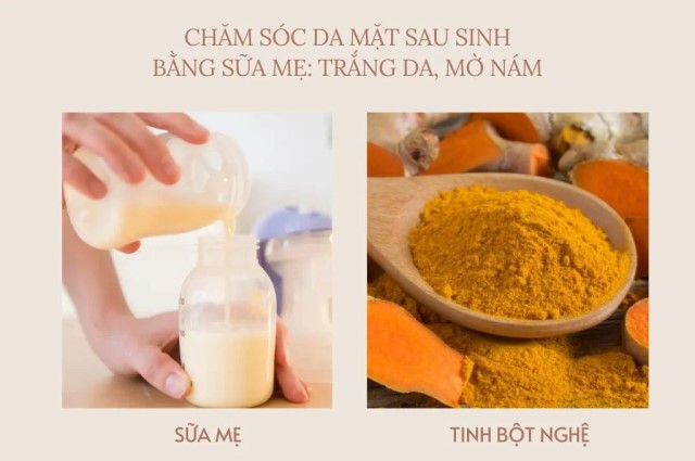 Cách chăm sóc da mặt sau sinh bằng sữa mẹ với tinh bột nghệ 