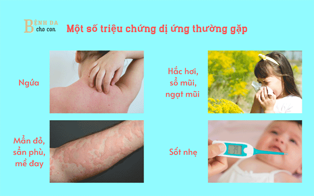 Ở trẻ dị ứng thời tiết có nhiều biểu hiện